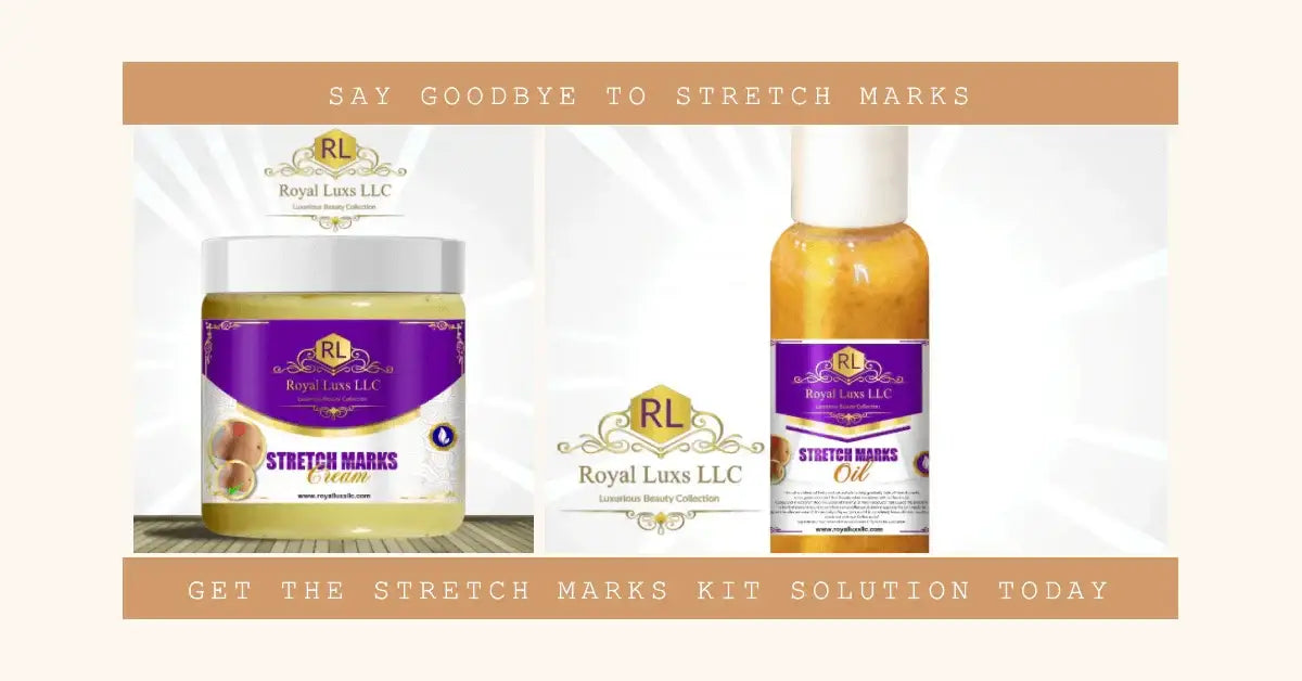 Stretch Marks Kit Solution by Royal Lux LLC, featuring Stretch Marks Cream and Stretch Marks Oil for skin wellness.